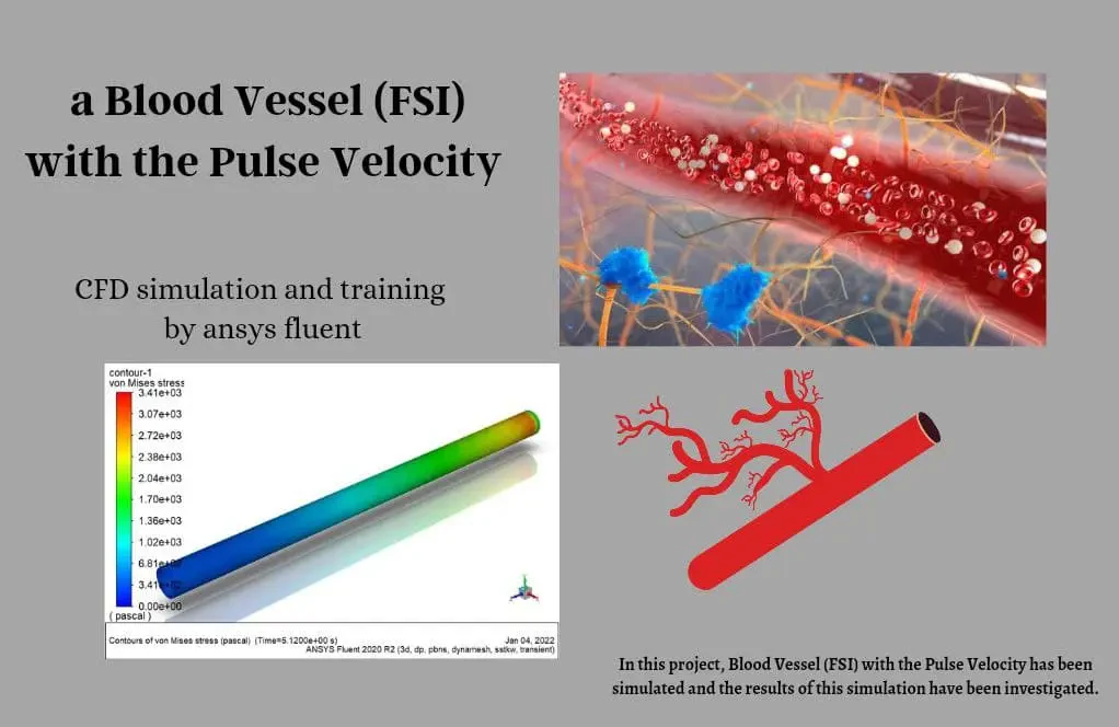 Blood Vessel (FSI) with the Pulse Velocity, CFD Simulation Ansys Fluent Training