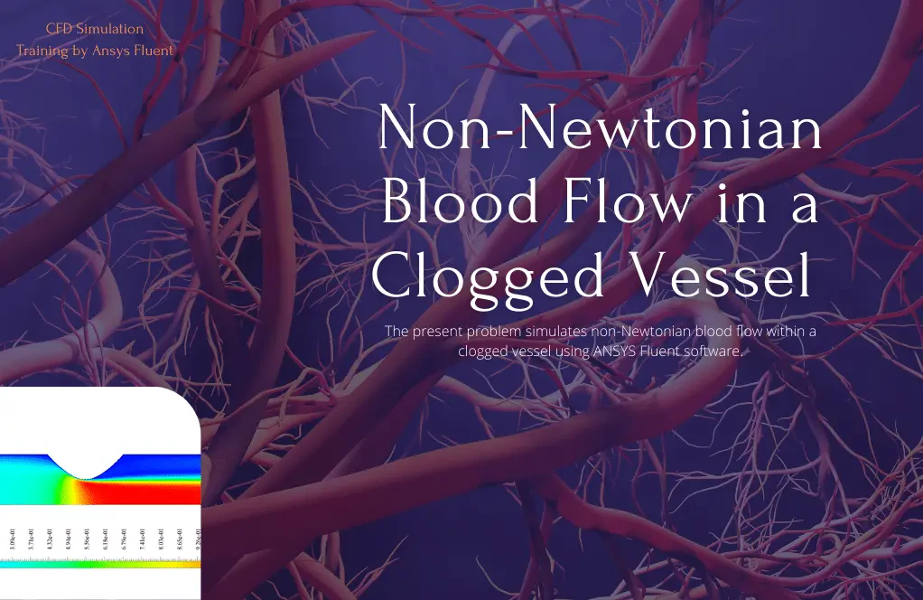 Non-Newtonian Blood Flow in a Clogged Vessel CFD Simulation, ANSYS Fluent