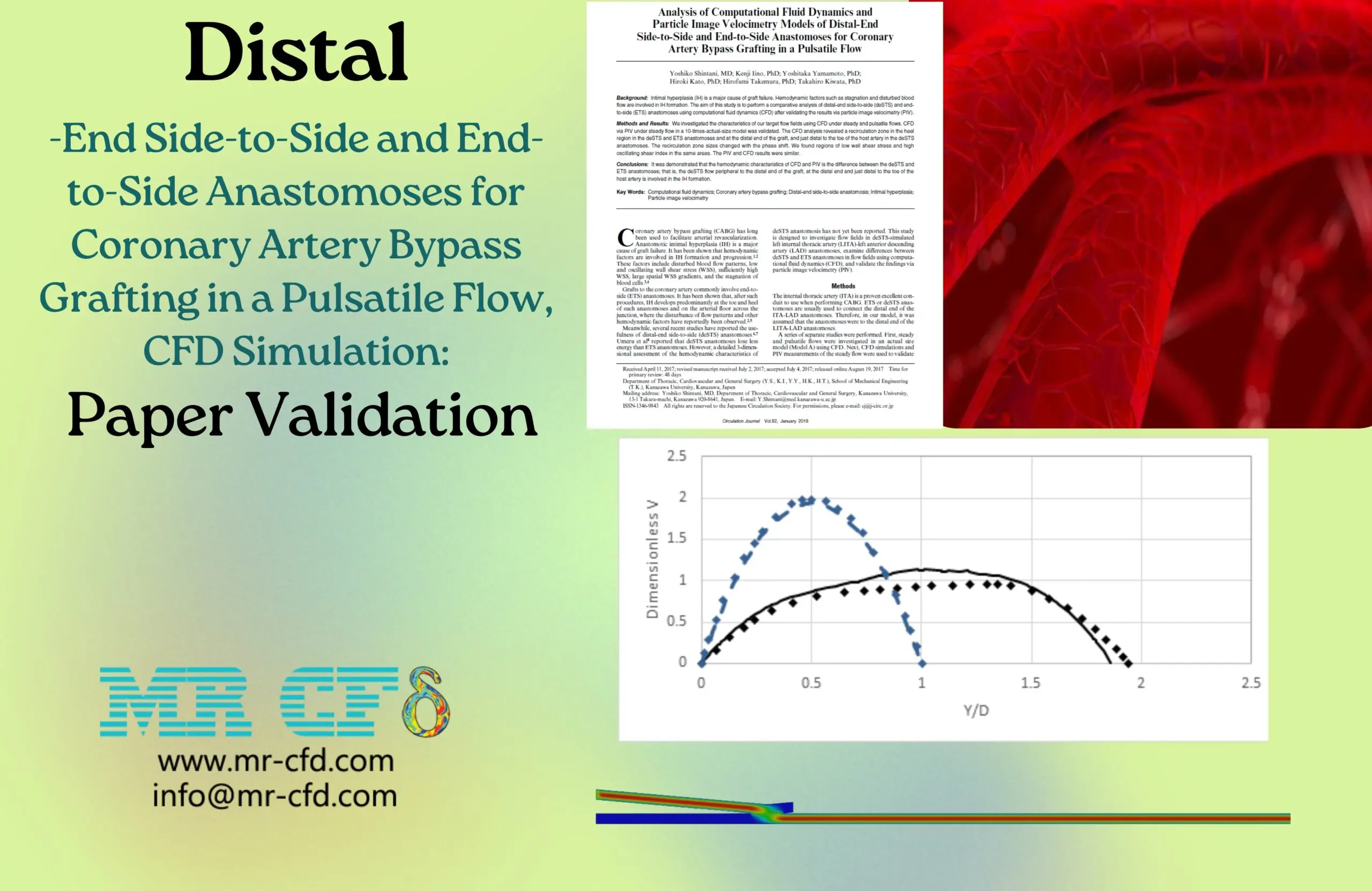 Distal-End Side-to-Side and End-to-Side Anastomoses for Coronary Artery Bypass Grafting in a Pulsatile Flow: Paper Validation